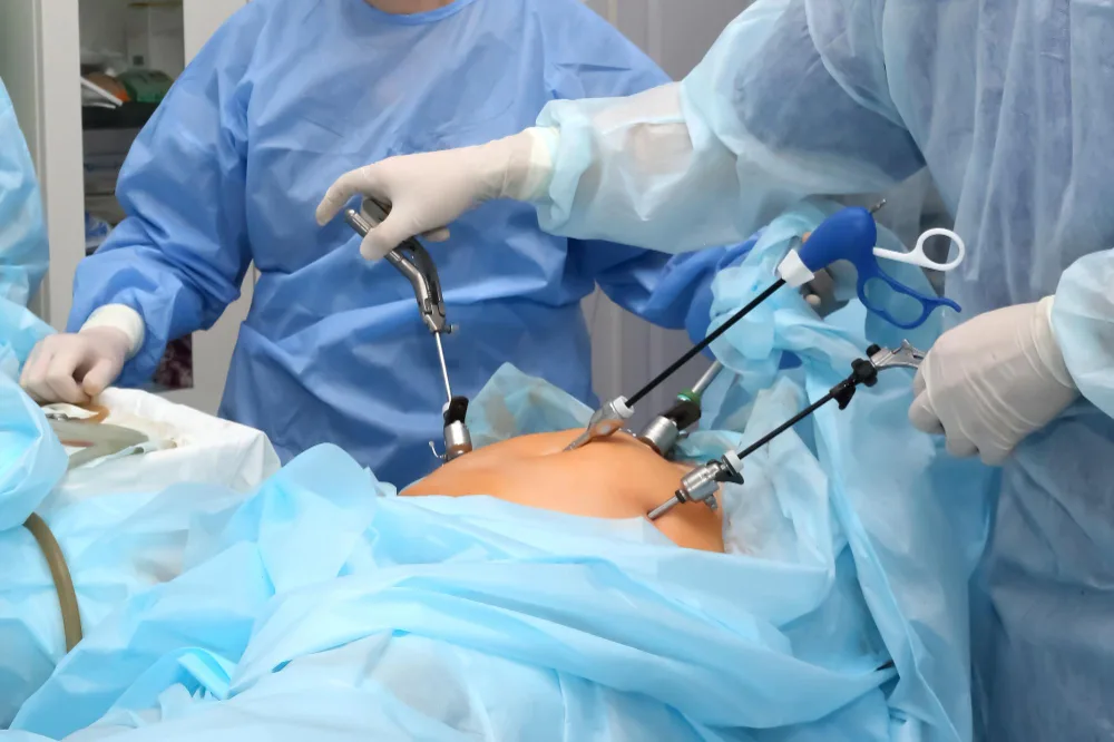 Cirugía laparoscópica para apendicitis