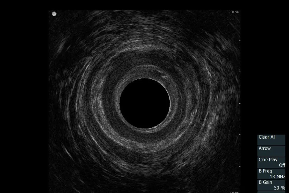 Ultrasonido endoanal y endorrectal 360° en Edo. Méx.